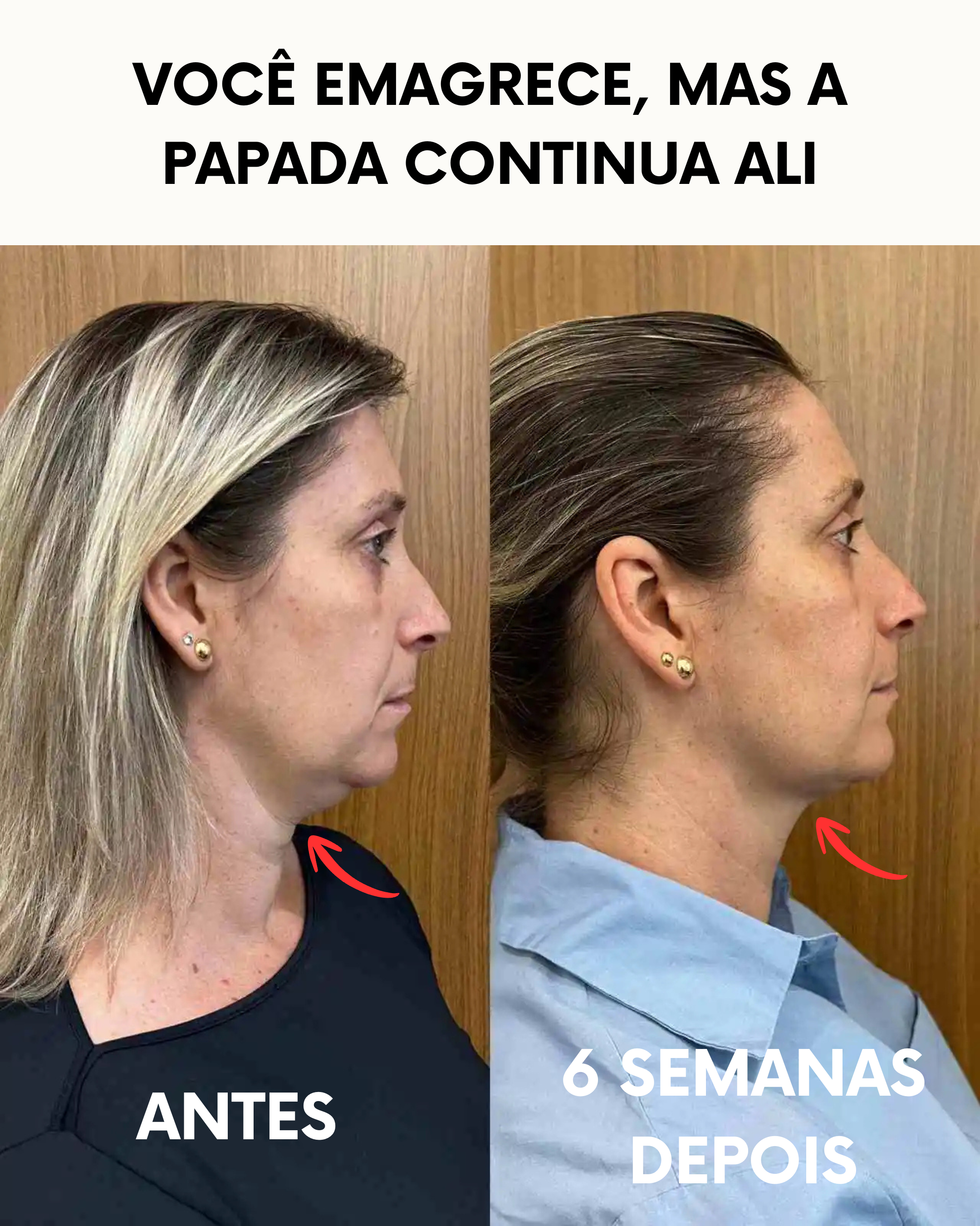 Máscara de Contorno Facial